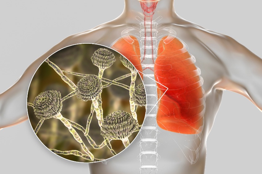 mycotoxins in the lungs