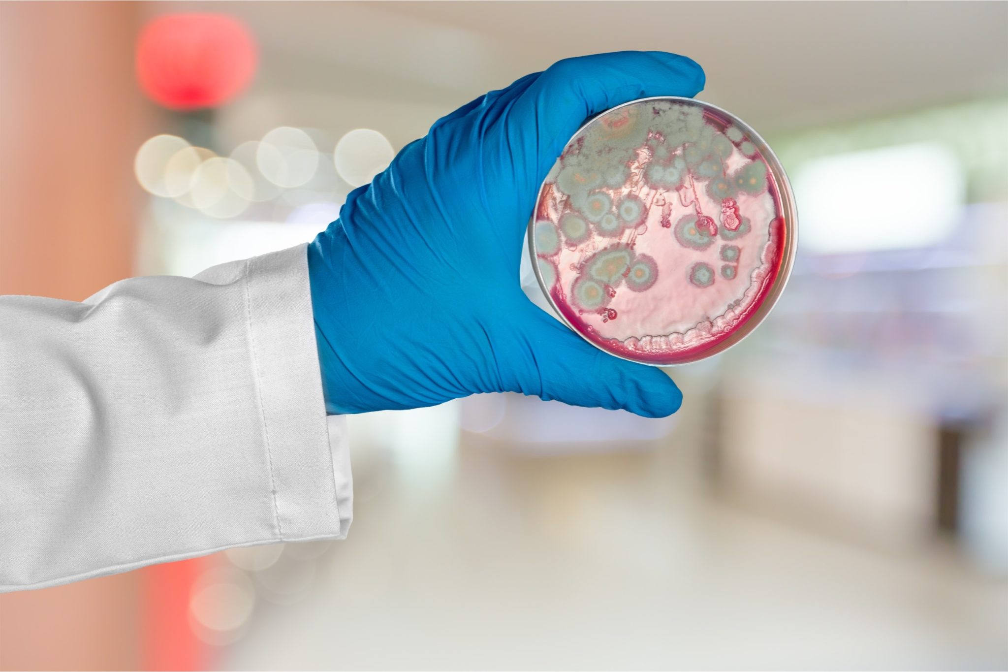 Why Sampling Mold Is Important